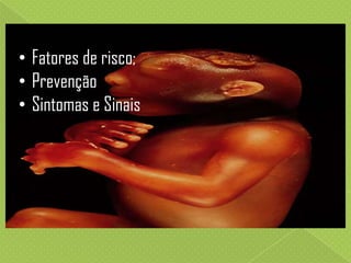 • Fatores de risco;
• Prevenção
• Sintomas e Sinais

 