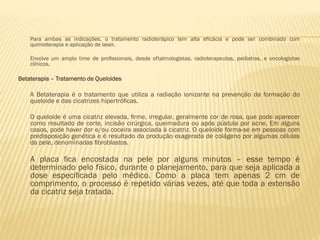 Para ambas as indicações, o tratamento radioterápico tem alta eficácia e pode ser combinado com
quimioterapia e aplicação de laser.
Envolve um amplo time de proﬁssionais, desde oftalmologistas, radioterapeutas, pediatras, e oncologistas
clínicos.

Betaterapia – Tratamento de Queloides

A Betaterapia é o tratamento que utiliza a radiação ionizante na prevenção da formação do
queloide e das cicatrizes hipertróﬁcas.
O queloide é uma cicatriz elevada, ﬁrme, irregular, geralmente cor de rosa, que pode aparecer
como resultado de corte, incisão cirúrgica, queimadura ou após pústula por acne. Em alguns
casos, pode haver dor e/ou coceira associada à cicatriz. O queloide forma-se em pessoas com
predisposição genética e é resultado da produção exagerada de colágeno por algumas células
da pele, denominadas ﬁbroblastos.

A placa ﬁca encostada na pele por alguns minutos – esse tempo é
determinado pelo físico, durante o planejamento, para que seja aplicada a
dose especiﬁcada pelo médico. Como a placa tem apenas 2 cm de
comprimento, o processo é repetido várias vezes, até que toda a extensão
da cicatriz seja tratada.

 