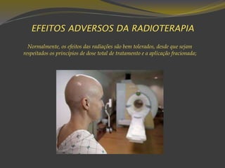 EFEITOS ADVERSOS DA RADIOTERAPIA
Normalmente, os efeitos das radiações são bem tolerados, desde que sejam
respeitados os princípios de dose total de tratamento e a aplicação fracionada;
 