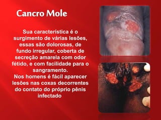 Sua característica é o
surgimento de várias lesões,
essas são dolorosas, de
fundo irregular, coberta de
secreção amarela com odor
fétido, e com facilidade para o
sangramento.
Nos homens é fácil aparecer
lesões nas coxas decorrentes
do contato do próprio pênis
infectado.
 