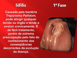 Causada pela bactéria
Treponema Pallidum,
pode atingir qualquer
tecido ou órgão e tende a
evoluir cronicamente. É
de fácil tratamento,
porém de extrema
preocupação pelo fato do
conhecimento das
conseqüências
decorrentes da evolução
da doença.
 