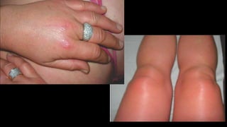 Apresentao1 141208182936-conversion-gate02