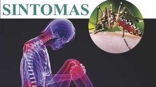 SINTOMAS 
 