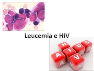leucemia e hiv