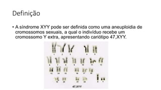 Definição
• A síndrome XYY pode ser definida como uma aneuploidia de
cromossomos sexuais, a qual o indivíduo recebe um
cromossomo Y extra, apresentando cariótipo 47,XYY.
 
