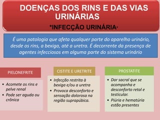 DOENÇAS DOS RINS E DAS VIAS
URINÁRIAS
*INFECÇÃO URINÁRIA*
É uma patologia que afeta qualquer parte do aparelho urinário,
desde os rins, a bexiga, até a uretra. É decorrente da presença de
agentes infecciosos em alguma parte do sistema urinário
PIELONEFRITE
• Acomete os rins e
pelve renal
• Pode ser aguda ou
crônica
CISTITE E URETRITE
• Infecção restrita à
bexiga e/ou a uretra
• Provoca desconforto e
sensação dolorosa na
região suprapúbica.
PROSTATITE
• Dor sacral que se
acompanha e
desconforto retal e
testicular.
• Piúria e hematúria
estão presentes
 