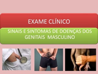 EXAME CLÍNICO
SINAIS E SINTOMAS DE DOENÇAS DOS
GENITAIS MASCULINO
 