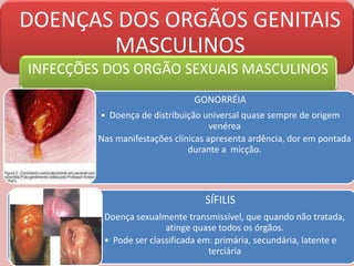 DOENÇAS DOS ORGÃOS GENITAIS
MASCULINOS
INFECÇÕES DOS ORGÃO SEXUAIS MASCULINOS
GONORRÉIA
• Doença de distribuição universal quase sempre de origem
venérea
• Nas manifestações clínicas apresenta ardência, dor em pontada
durante a micção.
SÍFILIS
• Doença sexualmente transmissível, que quando não tratada,
atinge quase todos os órgãos.
• Pode ser classificada em: primária, secundária, latente e
terciária
 