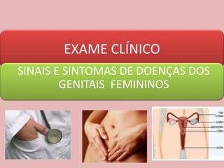 EXAME CLÍNICO
SINAIS E SINTOMAS DE DOENÇAS DOS
GENITAIS FEMININOS
 