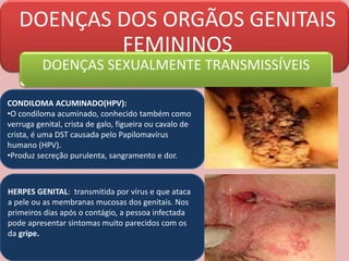 DOENÇAS DOS ORGÃOS GENITAIS
FEMININOS
DOENÇAS SEXUALMENTE TRANSMISSÍVEIS
CONDILOMA ACUMINADO(HPV):
•O condiloma acuminado, conhecido também como
verruga genital, crista de galo, figueira ou cavalo de
crista, é uma DST causada pelo Papilomavírus
humano (HPV).
•Produz secreção purulenta, sangramento e dor.
HERPES GENITAL: transmitida por vírus e que ataca
a pele ou as membranas mucosas dos genitais. Nos
primeiros dias após o contágio, a pessoa infectada
pode apresentar sintomas muito parecidos com os
da gripe.
 