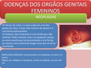 DOENÇAS DOS ORGÃOS GENITAIS
FEMININOS
NEOPLASIAS
•O câncer de vulva: é o que surge em uma das
partes da vulva. O tipo mais comum de câncer é o
carcinoma espinocelular.
•O sintoma mais frequente é uma ferida que não
cicatriza. Pode começar como um pequeno caroço,
ou uma mancha que vai aumentando e vira ferida,
ou mesmo uma coceira de longos anos que se torna
uma ferida.
NEOPLASIAS ANEXIAIS: Compreendem as neoplasias na tuba e no
ovário.
Podem ser malignas ou benignas, sendo as malignas, só cerca de
1%
 
