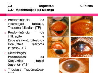 2.3 Aspectos Clínicos
2.3.1 Manifestação da Doença
 Predominância de
inflamação folicular,
Tracoma folicular- (TF)
 Predominância de
infiltração e
Espessamento difuso da
Conjuntiva, Tracoma
Intenso- (TI)
 Cicatrização
tracomatosa da
Conjuntiva tarsal
Superior- (TS)
 Triquíase Tracomatosa-
 