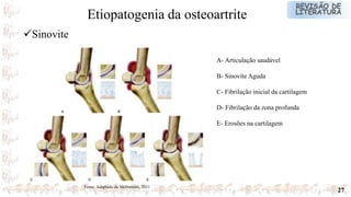 27
A- Articulação saudável
B- Sinovite Aguda
C- Fibrilação inicial da cartilagem
D- Fibrilação da zona profunda
E- Erosões na cartilagem
Fonte: Adaptado de Mcllwraith, 2011
Sinovite
Etiopatogenia da osteoartrite
 