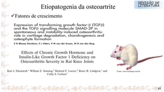 37
Fonte: www.teclasap.com.br
Fatores de crescimento
Etiopatogenia da osteoartrite
 