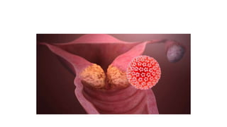 hpv.pptx