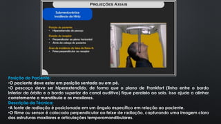 Posição do Paciente:
•O paciente deve estar em posição sentada ou em pé.
•O pescoço deve ser hiperextendido, de forma que o plano de Frankfort (linha entre o bordo
inferior da órbita e o bordo superior do canal auditivo) fique paralelo ao solo. Isso ajuda a alinhar
corretamente a mandíbula e os maxilares.
Descrição da Técnica:
•A fonte de radiação é posicionada em um ângulo específico em relação ao paciente.
•O filme ou sensor é colocado perpendicular ao feixe de radiação, capturando uma imagem clara
das estruturas maxilares e articulações temporomandibulares.
 