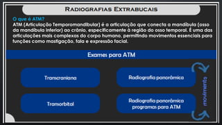 O que é ATM?
ATM (Articulação Temporomandibular) é a articulação que conecta a mandíbula (osso
da mandíbula inferior) ao crânio, especificamente à região do osso temporal. É uma das
articulações mais complexas do corpo humano, permitindo movimentos essenciais para
funções como mastigação, fala e expressão facial.
 