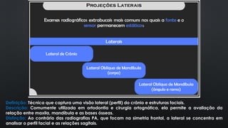 Definição: Técnica que captura uma visão lateral (perfil) do crânio e estruturas faciais.
Descrição: Comumente utilizada em ortodontia e cirurgia ortognática, ela permite a avaliação da
relação entre maxila, mandíbula e as bases ósseas.
Distinção: Ao contrário das radiografias PA, que focam na simetria frontal, a lateral se concentra em
analisar o perfil facial e as relações sagitais.
 