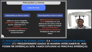 A CEFALOMÉTRICA EM NORMA LATERAL E A TELERRADIOGRAFIA EM NORMA
LATERAL SÃO FREQUENTEMENTE USADAS DE MANEIRA INTERCAMBIÁVEL, MAS
PODEM TER DIFERENÇAS SUTIS. VAMOS EXPLORAR AS PRINCIPAIS DIFERENÇAS:
 