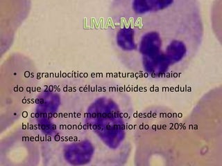  Leucemia   megacarioblástica aguda M7Leucemia monoblástica aguda  ou Leucemia monocítica aguda M5 Leucemia promielocítica aguda M3 Leucemia mielomonocítica aguda M4Subtipos de LMA Leucemia eritróide aguda ou Eritroleucemia M6Leucemia mieloblástica aguda sem diferenciação M1Leucemia mieloblástica aguda com maturação M2