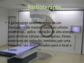 A LMA apresenta sintomas semelhantes a de outras doenças, o que torna difícil o seu diagnostico. O Mielograma é um exame muito importante para determinar a presença de células leucémicas na medula. Consiste na aspiração da medula óssea para observação microscópica .Diagnóstico 
