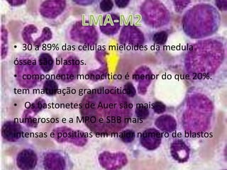 TrombocitopeniaSintomas 