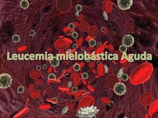 Leucemia mielobástica Aguda 