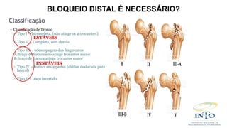 BLOQUEIO DISTAL É NECESSÁRIO?
 