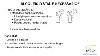 • FRATURAS ESTÁVEIS
• Estabilidade axial e rotacional
• Interdigitações do osso esponjoso
• Contato cortical
• Parede póstero medial intacta
• Hastes sem bloqueio distal
Kane et al
• Estudo em cadáver
• 1 parafuso distal para fx estáveis em hastes longas
• Aumenta estabilidade rotacional e rigidez
BLOQUEIO DISTAL É NECESSÁRIO?
 
