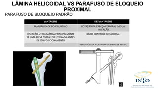 PARAFUSO DE BLOQUEIO PADRÃO
VANTAGENS DESVANTAGENS
FAMILIARIDADE DO CIRURGIÃO ROTAÇÃO DA CABEÇA FEMORAL EM SUA
INSERÇÃO
INSERÇÃO A TRAUMÁTICA PRINCIPALMENTE
SE UMA FRESA ÓSSEA FOR UTILIZADA ANTES
DE SEU POSICIONAMENTO
BAIXO CONTROLE ROTACIONAL
PERDA ÓSSEA COM USO DA BROCA E FRESA
LÂMINA HELICOIDAL VS PARAFUSO DE BLOQUEIO
PROXIMAL
 