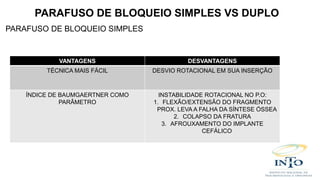 PARAFUSO DE BLOQUEIO SIMPLES
PARAFUSO DE BLOQUEIO SIMPLES VS DUPLO
VANTAGENS DESVANTAGENS
TÉCNICA MAIS FÁCIL DESVIO ROTACIONAL EM SUA INSERÇÃO
ÍNDICE DE BAUMGAERTNER COMO
PARÂMETRO
INSTABILIDADE ROTACIONAL NO P.O:
1. FLEXÃO/EXTENSÃO DO FRAGMENTO
PROX. LEVA A FALHA DA SÍNTESE ÓSSEA
2. COLAPSO DA FRATURA
3. AFROUXAMENTO DO IMPLANTE
CEFÁLICO
 