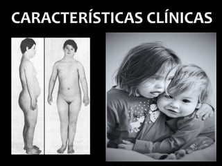 CARACTERÍSTICAS CLÍNICAS
 