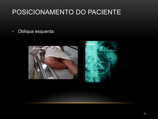 POSICIONAMENTO DO PACIENTE
14
• Obliqua esquerda
 