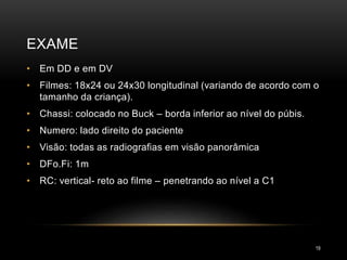 EXAME
19
• Em DD e em DV
• Filmes: 18x24 ou 24x30 longitudinal (variando de acordo com o
tamanho da criança).
• Chassi: colocado no Buck – borda inferior ao nível do púbis.
• Numero: lado direito do paciente
• Visão: todas as radiografias em visão panorâmica
• DFo.Fi: 1m
• RC: vertical- reto ao filme – penetrando ao nível a C1
 