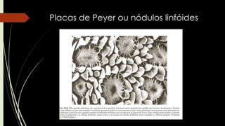 Placas de Peyer ou nódulos linfóides
 