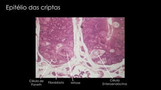 Epitélio das criptas
Célula de
Paneth
Fibroblasto Mitose
Célula
Enteroendócrina
 