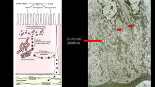 Gotículas
Lipídicas
 