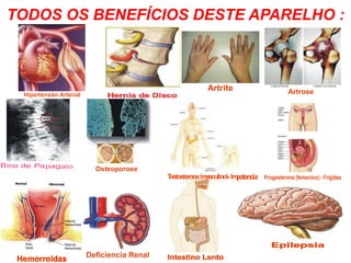 TODOS OS BENEFÍCIOS DESTE APARELHO :
Hipertensão Arterial
Artrite Artrose
Osteoporose
Bico de Papagaio
Testosterona(masculino)-Impotencia Progesterona (femenino) - Frigidez
Deficiencia Renal
 
