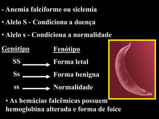 - Anemia falciforme ou siclemia
• Alelo S - Condiciona a doença
• Alelo s - Condiciona a normalidade
Genótipo         Fenótipo
   SS            Forma letal
   Ss            Forma benigna
    ss           Normalidade
 • As hemácias falcêmicas possuem
 hemoglobina alterada e forma de foice
 