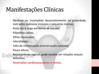 Manifestações Clínicas
• Nenhum ou incompleto desenvolvimento na puberdade,
com pelos pubianos escassos e pequenas mamas;
• Peito liso e largo em forma de escudo;
• Pálpebras caídas;
• Olhos ressecados;
• Infertilidade;
• Falta de menstruação (menstruação ausente);
• Pouca altura;
• Ressecamento vaginal, pode resultar em relações sexuais
dolorosas.
• Anomalias cardiovasculares e renais.
 