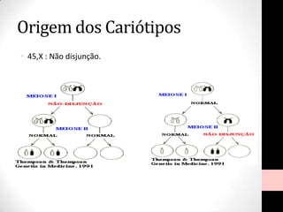 Origem dos Cariótipos
• 45,X : Não disjunção.
 