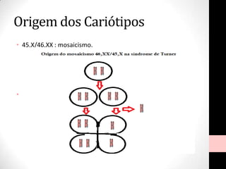 Origem dos Cariótipos
• 45,X/46,XX : mosaicismo.
• 45,X/46,XX/47,XXX
 