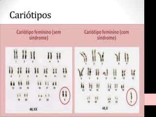 Cariótipos
 