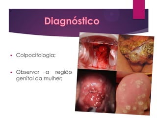 

Colpocitologia;



Observar a região
genital da mulher;

 