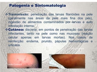 Patogenia e Sintomatologia

Transmissão: penetração das larvas filarióides na pele
 (geralmente nas áreas da pele mais fina dos pés),
 ingestão de alimentos contaminados por larvas e auto
 infestação interna.
Cutánea: discreta, em pontos de penetração das larvas
 infectantes, tanto na pele como nas mucosas (reação
 celular apenas em larvas mortas). Nos casos de
 reinfecção: endema, prurido, pápulas hemorrágicas e
 urticária.
                                        Lesão Cutánea




 Lesão Cutánea
 