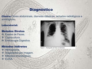 Diagnóstico
Clínico: Dores abdominais, diarreias clássicas, achados radiológicos e
sorológicos.

Laboratorial:

Métodos Diretos
                                    ia
 Exame de Fezes.
 Coprocultura.
 Endoscopia Digestiva.

Métodos Indiretos
 Hemograma.
 Diagnóstico por Imagem.
 Métodos Imunológicos.
 ELISA.
 