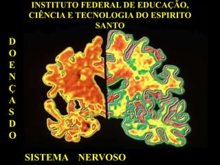 INSTITUTO FEDERAL DE EDUCAÇÃO,
CIÊNCIA E TECNOLOGIA DO ESPIRITO
SANTO
D
O
E
N
Ç
A
S
D
O
SISTEMA NERVOSO
 