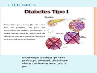 TIPOS DE DIABETES
Diabetes tipo 1
A apresentação do diabetes tipo 1 é em
geral abrupta, acometendo principalmente
crianças e adolescentes sem excesso de
peso.
 