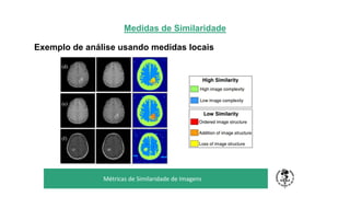 Medidas de Similaridade
Exemplo de análise usando medidas locais
TÍTULO DO SEU SEMINÁRIO
Subtítulo
Métricas de Similaridade de Imagens
 