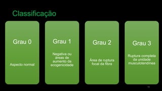 Classificação
14
Grau 0
Aspecto normal
Grau 1
Negativa ou
áreas de
aumento da
ecogenicidade
Grau 2
Área de ruptura
focal da fibra
Grau 3
Ruptura completa
da unidade
musculotendínea
 